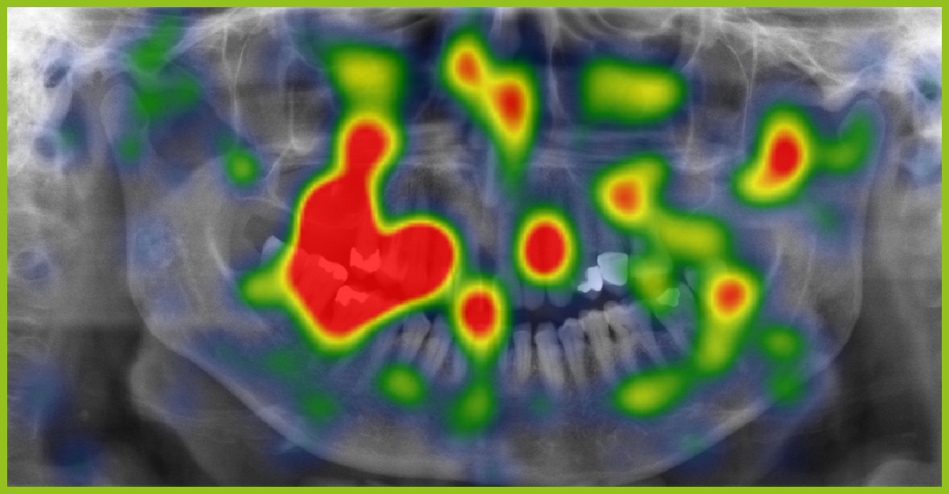 05_OPT_HeatMap_Bsp_Projekt5-5